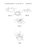 PORTION PACKAGE AND SEMI-FLUID PRODUCT diagram and image