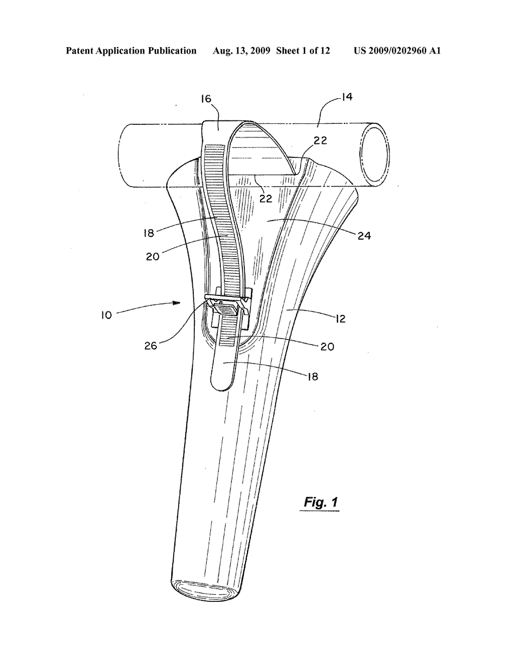 MEDICAL/DENTAL SUCTION NOZZLE HOLSTER HAVING A UNIVERSALLY ADJUSTABLE STRAP - diagram, schematic, and image 02