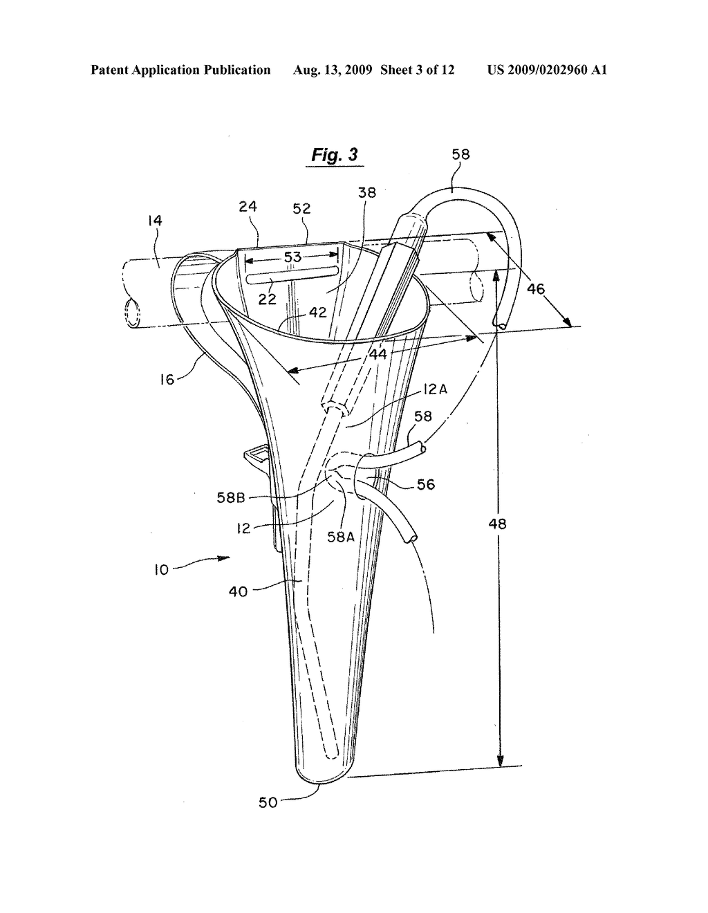 MEDICAL/DENTAL SUCTION NOZZLE HOLSTER HAVING A UNIVERSALLY ADJUSTABLE STRAP - diagram, schematic, and image 04