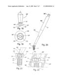 Dynamic Pillar for Correcting Incorrectly Positioned Implants and a Toll Therefor diagram and image