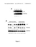 Modulation of the integrin-linked kinase signaling pathway provides beneficial human cardiac hypertrophy and post myocardial infarction remodeling diagram and image