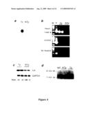 Modulation of the integrin-linked kinase signaling pathway provides beneficial human cardiac hypertrophy and post myocardial infarction remodeling diagram and image