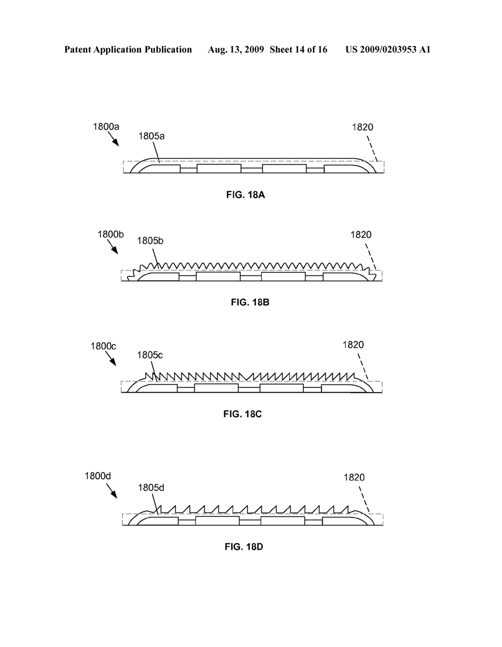 THERAPEUTIC MEMBER INCLUDING A RAIL TO RESIST MOVEMENT WITHIN A NEEDLE USED IN BRACHYTHERAPY AND OTHER RADIATION THERAPY - diagram, schematic, and image 15