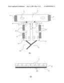 NEONATE OR INFANT PULSATING WEAR diagram and image