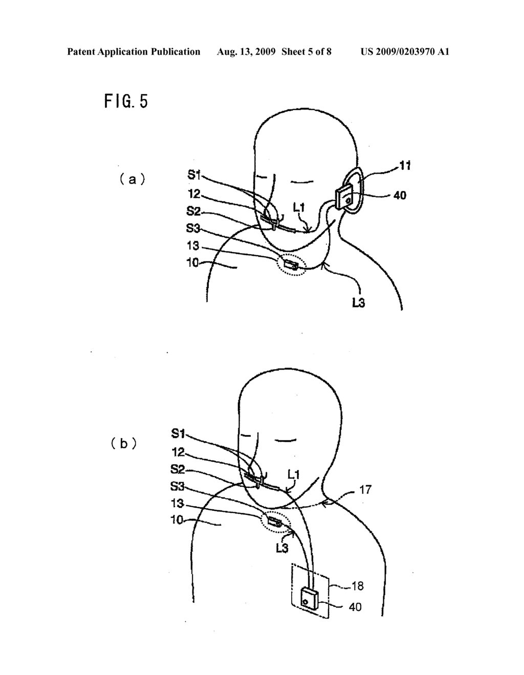 SLEEP APNEA TEST SENSOR ASSEMBLY AND SLEEP APNEA TEST EQUIPMENT USING THE SAME - diagram, schematic, and image 06