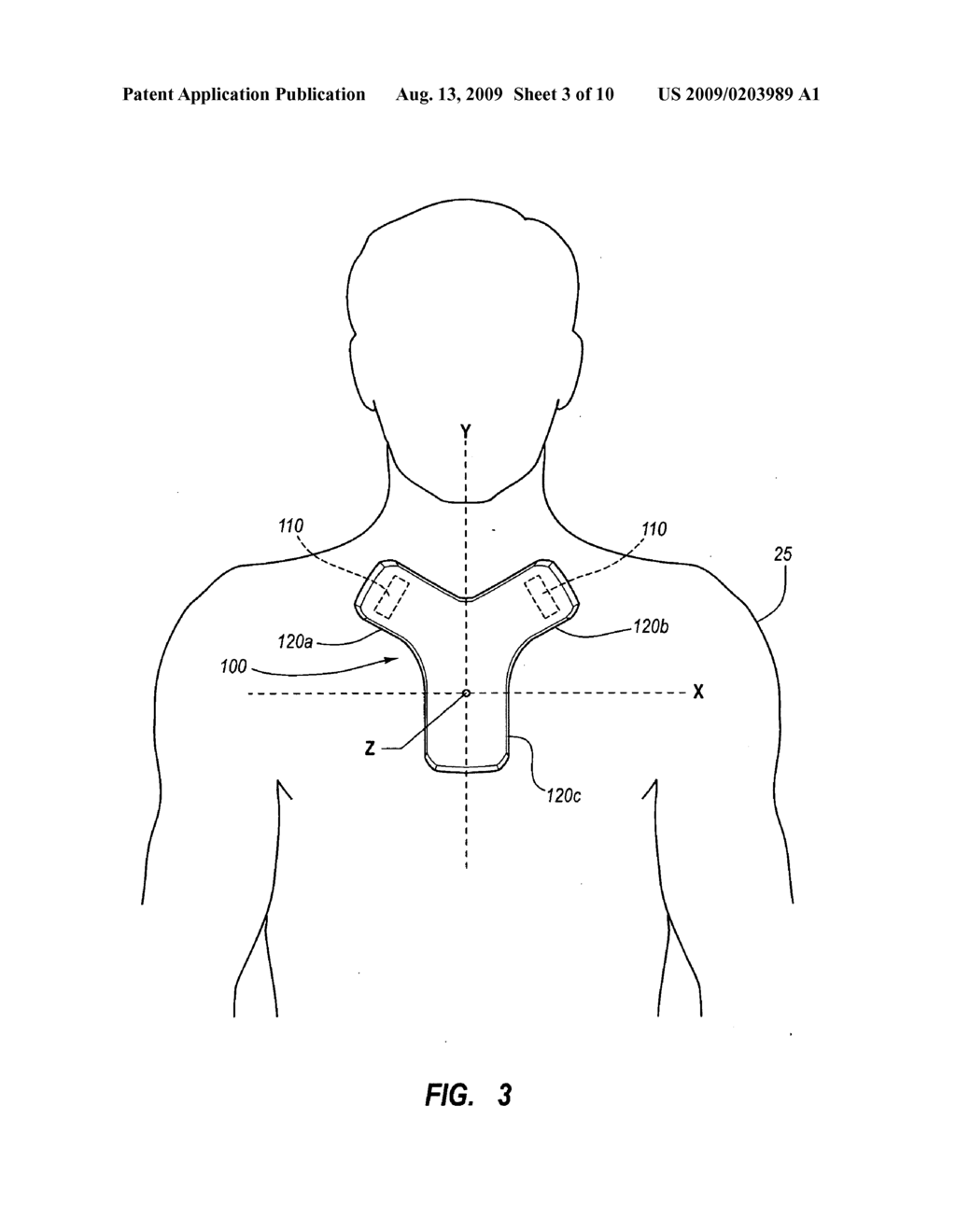 SYSTEMS AND METHODS FOR POSITIONING A CATHETER - diagram, schematic, and image 04