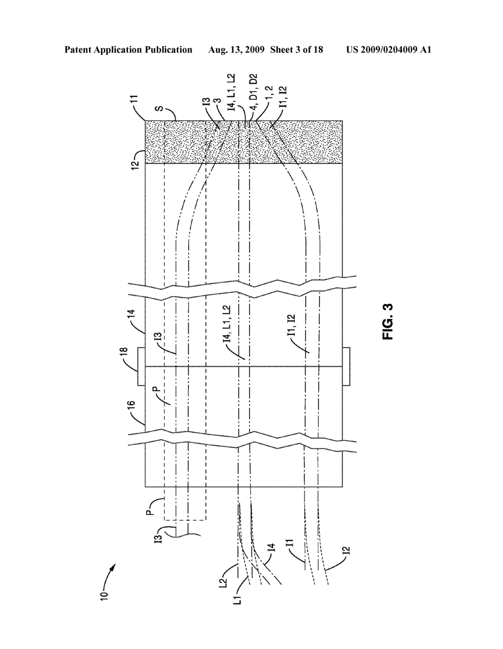 MEDICAL DEVICE SYSTEM AND RELATED METHODS FOR DIAGNOSING ABNORMAL MEDICAL CONDITIONS BASED ON IN-VIVO OPTICAL PROPERTIES OF TISSUE - diagram, schematic, and image 04