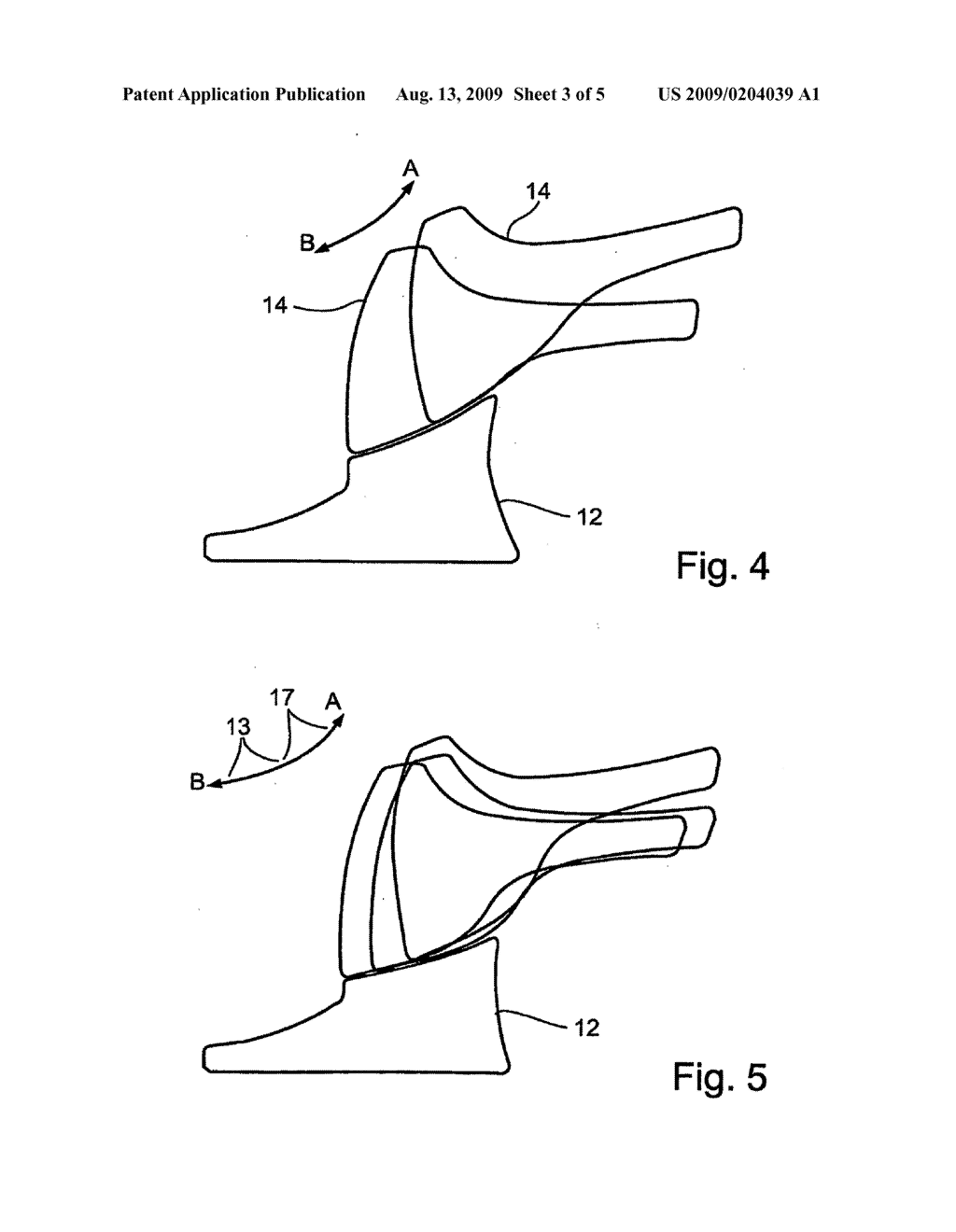 Device and Method for Treating Neck Tension or Neck Injury - diagram, schematic, and image 04