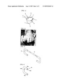 Corrective Device for Ingrown Toenail and Incurvated Toenail diagram and image