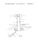 Two-part percutaneous endoscopic intragastric surgery cannula diagram and image