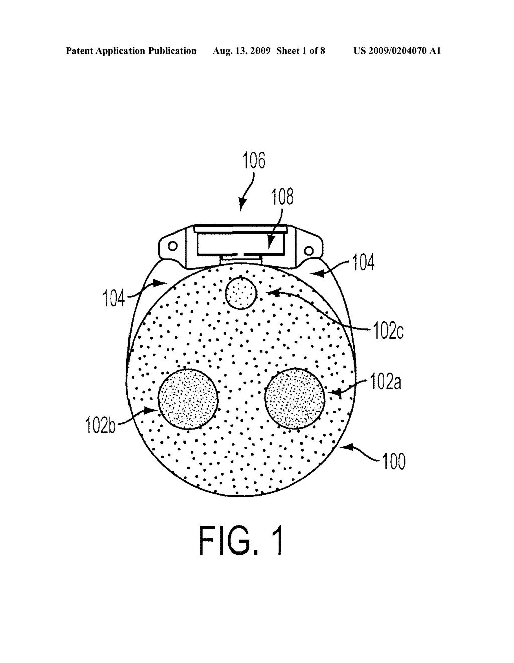 EXTRAVASATION DETECTION DEVICE - diagram, schematic, and image 02