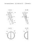 CATHETERS WITH ENLARGED ARTERIAL LUMENS diagram and image