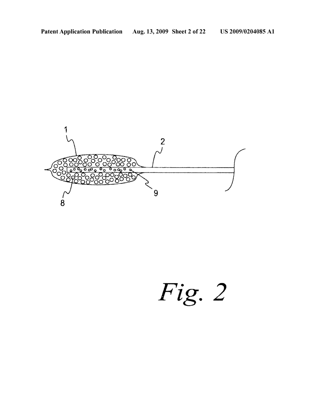 CLOSED WOUND DRAINAGE SYSTEM - diagram, schematic, and image 03