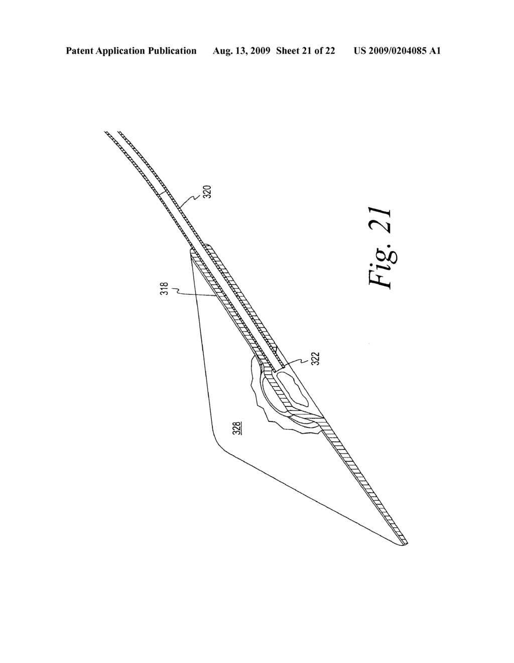 CLOSED WOUND DRAINAGE SYSTEM - diagram, schematic, and image 22