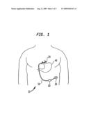 POWERING IMPLANTABLE RESTRICTION SYSTEMS USING KINETIC MOTION diagram and image