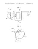 POWERING IMPLANTABLE RESTRICTION SYSTEMS USING KINETIC MOTION diagram and image