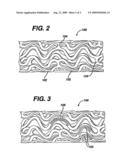 Drug/Drug Deliver Systems For The Prevention And Treatment Of Vascular Disease diagram and image