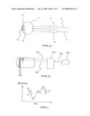 Logarithmic Light Intensifier for use with Photoreceptor-Based Implanted Retinal Prosthetics and those Prosthetics diagram and image