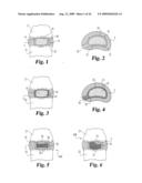 Intervertebral Disc Nucleus Implants and Methods diagram and image