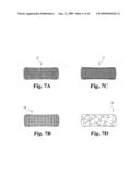 Intervertebral Disc Nucleus Implants and Methods diagram and image