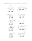 Intervertebral Disc Nucleus Implants and Methods diagram and image