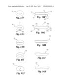 Intervertebral Disc Nucleus Implants and Methods diagram and image