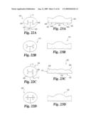 Intervertebral Disc Nucleus Implants and Methods diagram and image