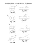 Intervertebral Disc Nucleus Implants and Methods diagram and image