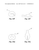 Intervertebral Disc Nucleus Implants and Methods diagram and image