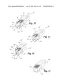 Intervertebral Disc Nucleus Implants and Methods diagram and image