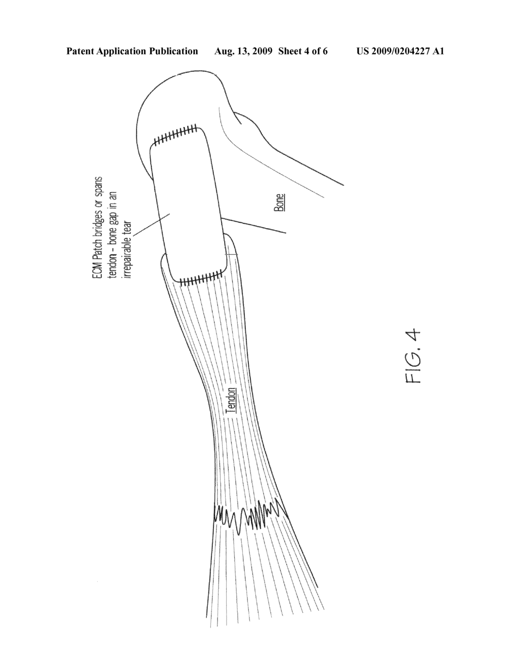 Molecular enhancement of extracellular matrix and methods of use - diagram, schematic, and image 05