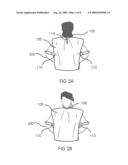 Disposable Over-Garment diagram and image