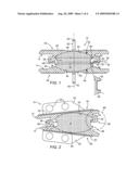 Intervertebral Prosthetic Disc With Metallic Core diagram and image