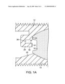 Intervertebral Prosthetic Disc With Metallic Core diagram and image