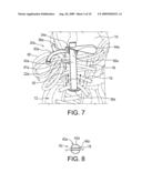 TIGHTENING DEVICE FOR SIMPLIFYING THE TIGHTENING AND LOOSENING OF SHOE LACES diagram and image