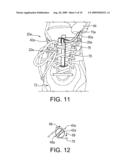 TIGHTENING DEVICE FOR SIMPLIFYING THE TIGHTENING AND LOOSENING OF SHOE LACES diagram and image