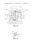 TIGHTENING DEVICE FOR SIMPLIFYING THE TIGHTENING AND LOOSENING OF SHOE LACES diagram and image