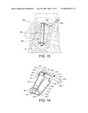 TIGHTENING DEVICE FOR SIMPLIFYING THE TIGHTENING AND LOOSENING OF SHOE LACES diagram and image