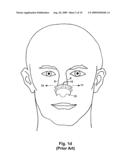 APPARATUS AND METHOD FOR IMPROVING NASAL BREATHING diagram and image