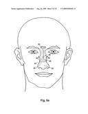 APPARATUS AND METHOD FOR IMPROVING NASAL BREATHING diagram and image