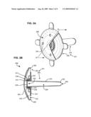 PNEUMOSTOMA MANAGEMENT SYSTEM HAVING A COSMETIC AND/OR PROTECTIVE COVER diagram and image