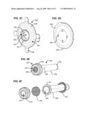 PNEUMOSTOMA MANAGEMENT SYSTEM HAVING A COSMETIC AND/OR PROTECTIVE COVER diagram and image