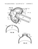 PNEUMOSTOMA MANAGEMENT SYSTEM HAVING A COSMETIC AND/OR PROTECTIVE COVER diagram and image