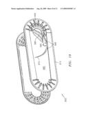 Suture Packaging diagram and image