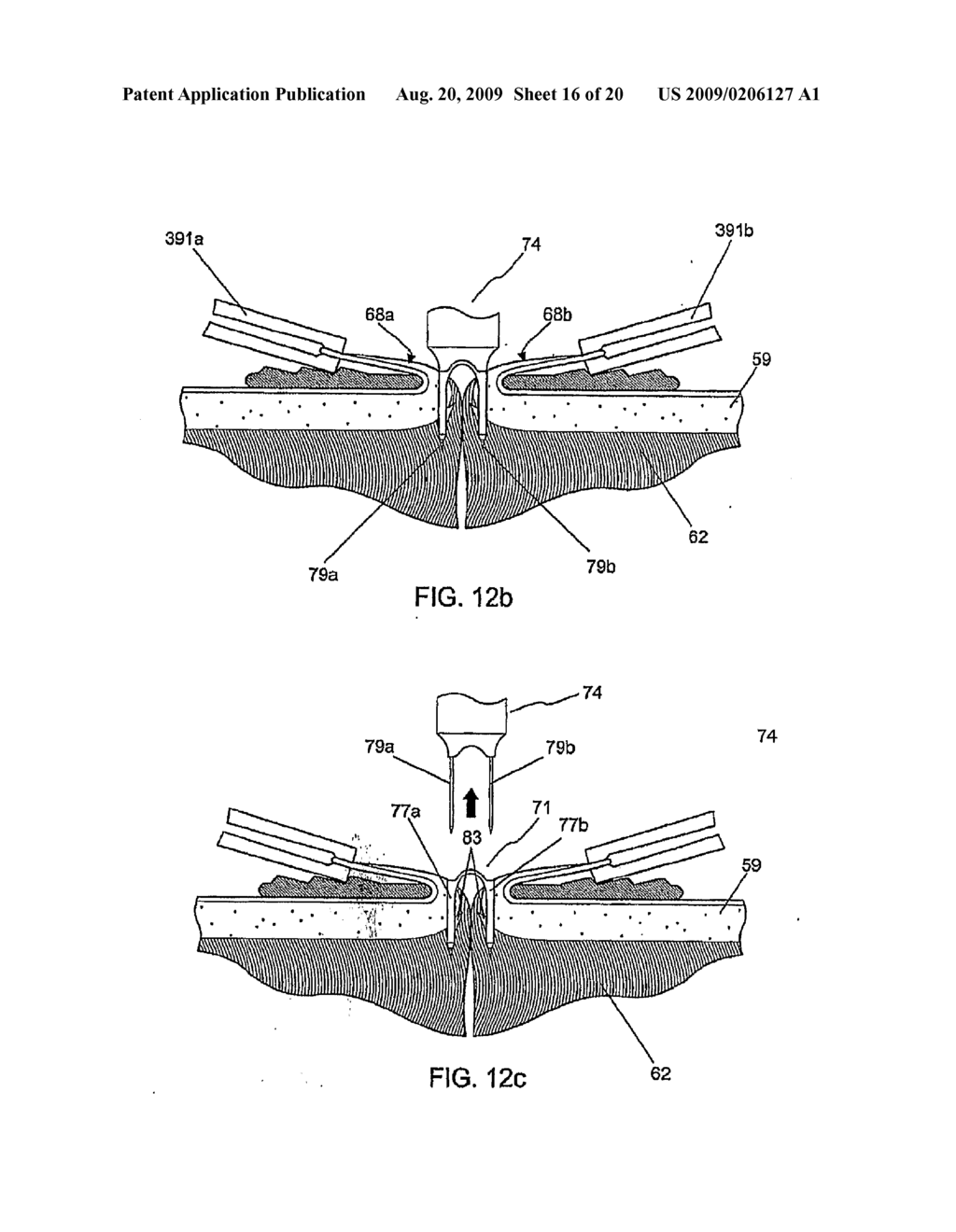 TISSUE FASTENERS AND RELATED INSERTION DEVICES, MECHANISMS, AND METHODS - diagram, schematic, and image 17