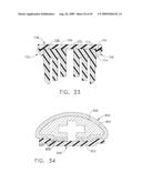 BUTTRESS MATERIAL FOR A SURGICAL STAPLING INSTRUMENT diagram and image