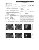 Systems and Methods for Correction of Inhomogeneities in Magnetic Resonance Images diagram and image