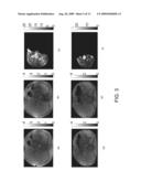 Systems and Methods for Correction of Inhomogeneities in Magnetic Resonance Images diagram and image