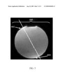 Systems and Methods for Correction of Inhomogeneities in Magnetic Resonance Images diagram and image