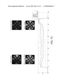 Systems and Methods for Correction of Inhomogeneities in Magnetic Resonance Images diagram and image